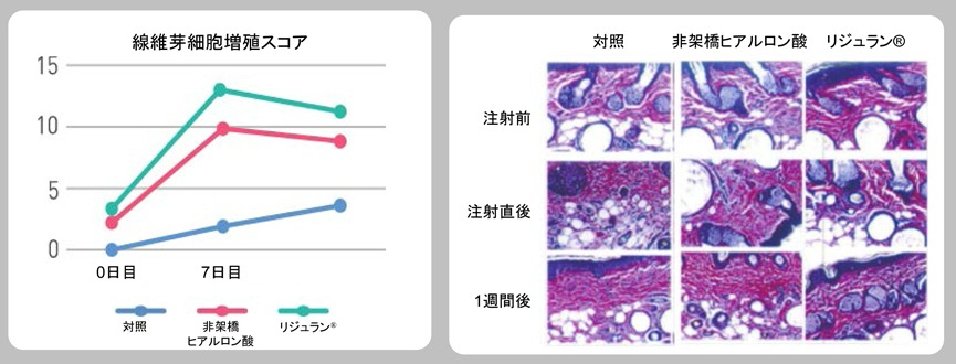リジュラン1.jpg