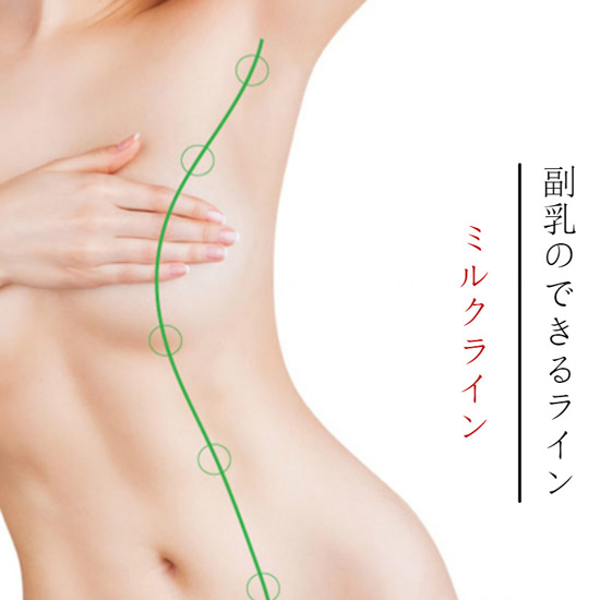 副乳摘出nishiyama-1.jpg