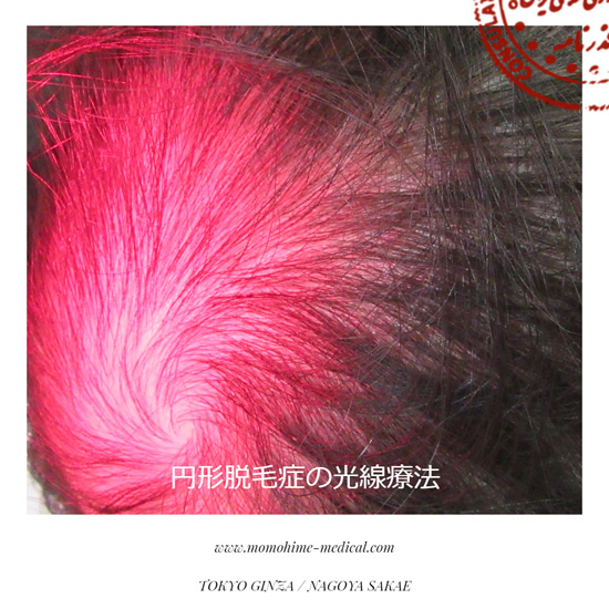 alopetia-nishiyama2.jpg
