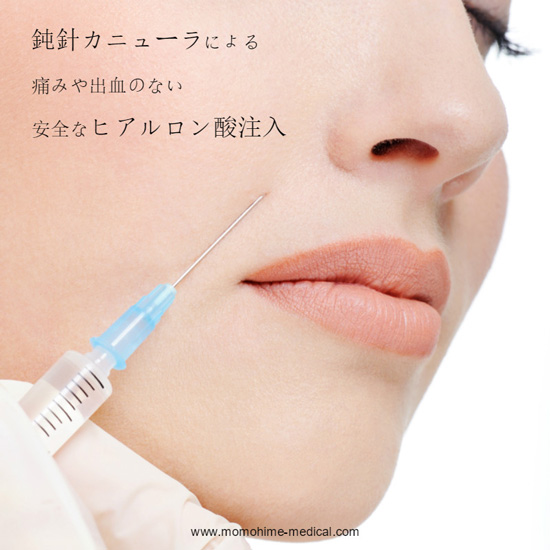 hyaluronic-acid-injection-n.jpg