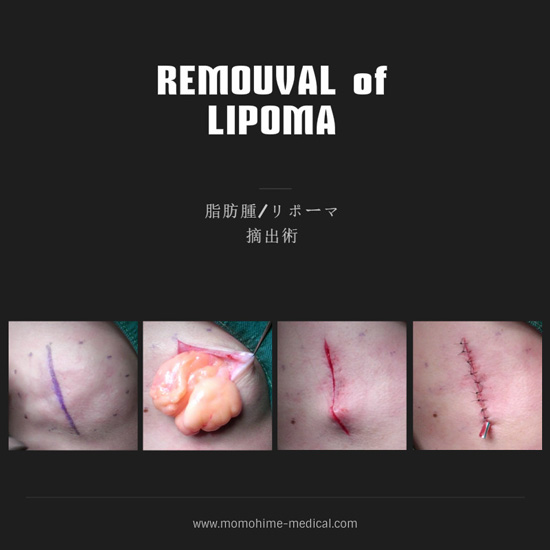 lopoma-nishiyama-1.jpg