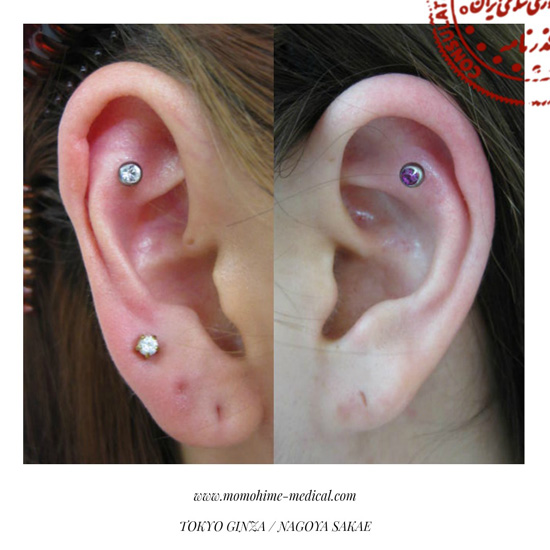 medical-piercing-nishiyama5.jpg