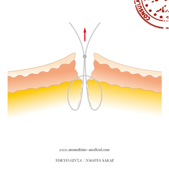 suture-nishiyama1-2.jpg