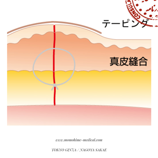 suture-nishiyama1-4.jpg