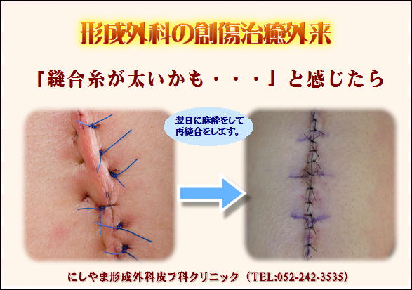 ふじた式整体科学 刻まれた不調の痕跡 傷跡修正 | 横浜市鶴見の形成・美容外科 エムズクリニック